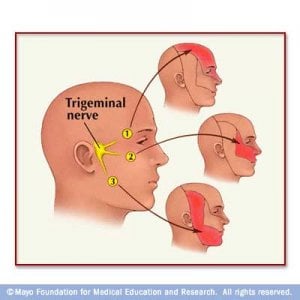 Trigemina Nerve Pic.jpg