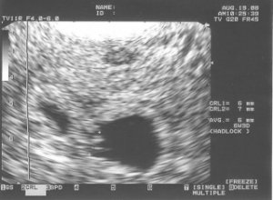 USTwins8-19(6wks)BW.jpg