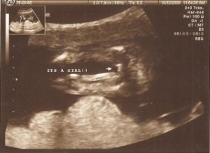 USGirl -12Wks.jpg