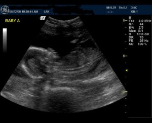 baby a 16 wks to post.JPG