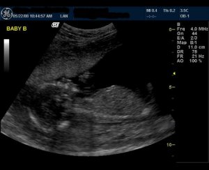 baby b 16 wks to post.JPG