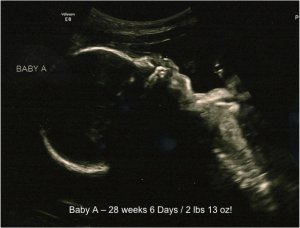 BabyA28w6days.jpg