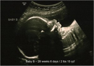 BabyB28w6days_.jpg