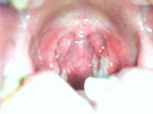 throat5708.JPG