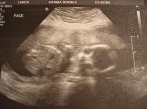 20 weeks dreamer 2.jpg