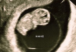 babyMar24cropped.jpg