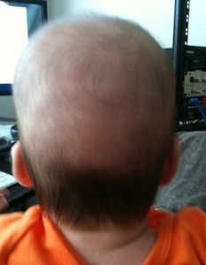 babybaldspot.jpg