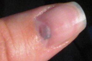 Finger day two afternoon 2.jpg