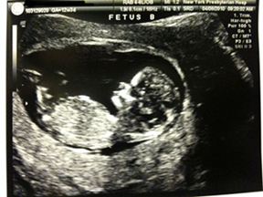 Baby B - 4-8-10.jpg