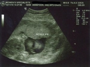 24wks-d.jpg