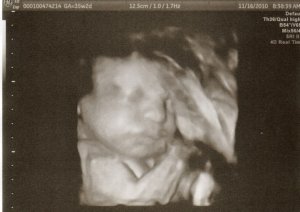 lynnbaby35w2.jpg