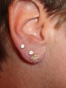 ear2 (450 x 600).jpg