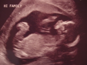 Baby%20Rose%2019%20Weeks%20002.jpg