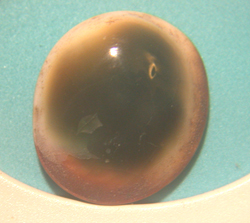 Operculum 2 a sm.jpg