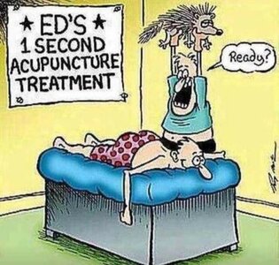 acupuncture.jpg