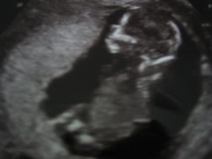 BabyB_0427_12weeks.JPG